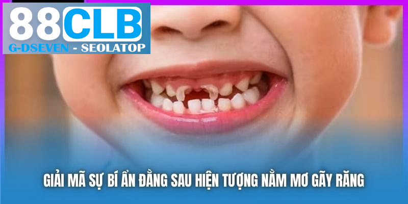 Giải mã sự bí ẩn đằng sau hiện tượng nằm mơ gãy răng Giải mã sự bí ẩn đằng sau hiện tượng nằm mơ gãy răng